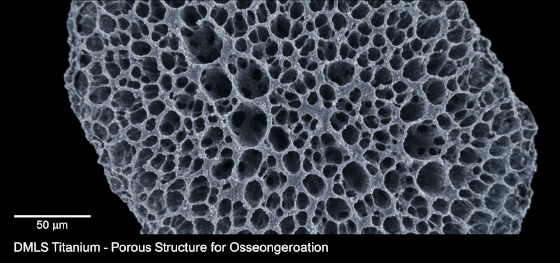microscopic trabecular bone structure